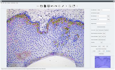 OralImmunoAnalyser: a software tool for immunohistochemical assessment of oral leukoplakia using image segmentation and classification models